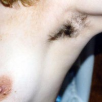 Leesa