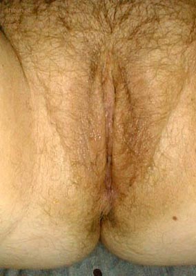 Pic #1Submission