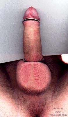 Pic #1Alternative