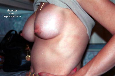 Pic #1Before and After's