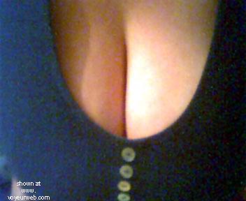Pic #1 Breasts