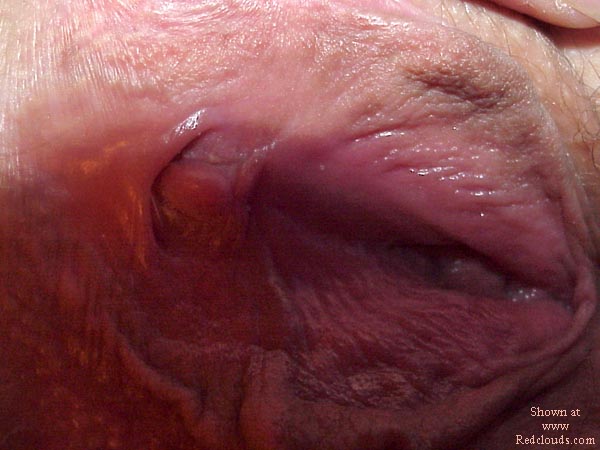 Pic #1Winger &amp; S Part II