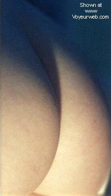 Pic #1Emma's skin