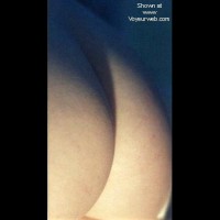 Emma's skin