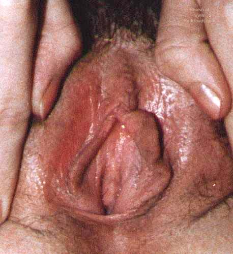 Pic #1Various Louise Photos