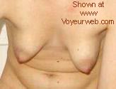 Pic #1TITs VARIATIONS