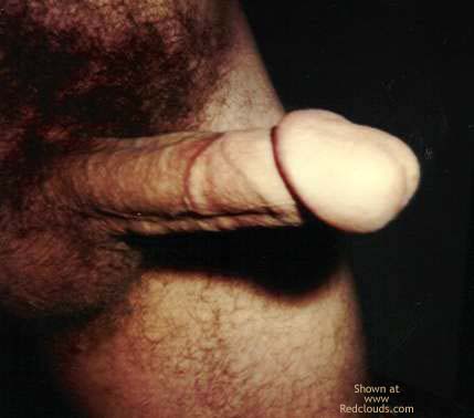Pic #1My Contri