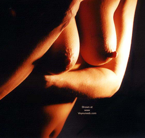 Pic #1*NC Permanently Erect