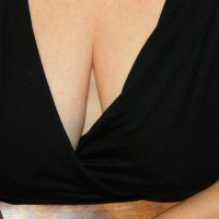 Pic #1 Breast Perspective
