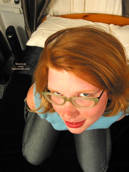 Pic #1Madison'S Sunburn