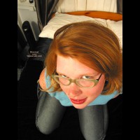 Pic #1Madison'S Sunburn