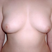 Pic #1Sarah, Two Years Later