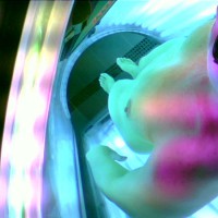 Sunbed