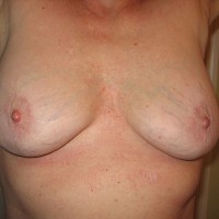 My Wife