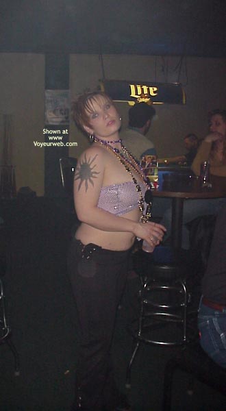 Pic #1Before And After Contest