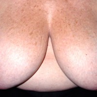 Pic #1 Topless Amateur Monter 30 Lbs. Of Breasts