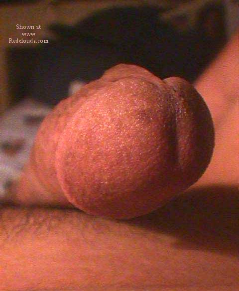 Pic #1M* the analsyt