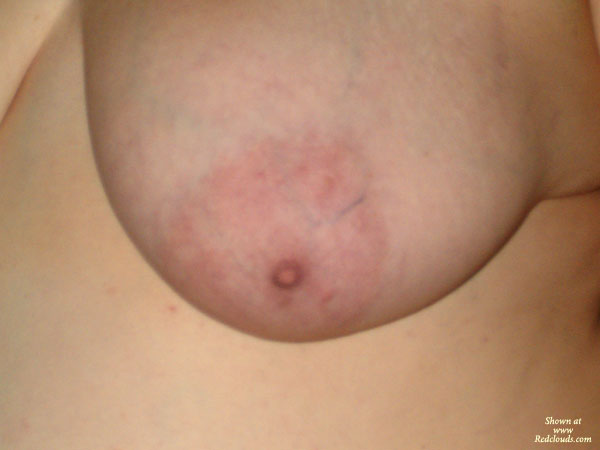 Pic #1Round Tits