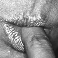 fi - A Dissertation On The Finger