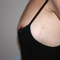 Pic #1 More