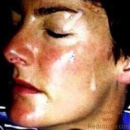 Pic #1Facial!