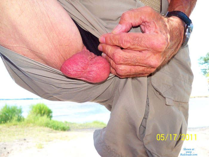 Pic #1My Ugly Balls