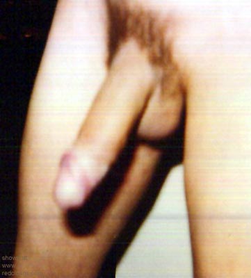 Pic #1My Turn