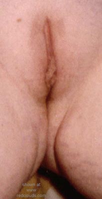 Pic #1My Ex, posing