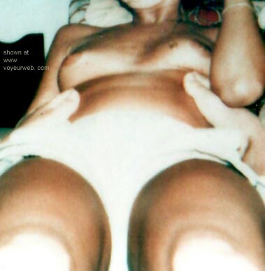 Pic #1Blond      And Bald