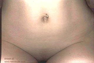 Pic #1