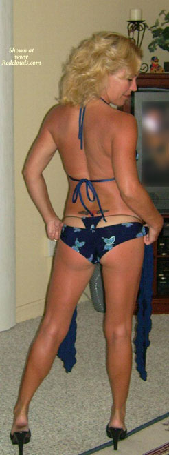 Pic #1Shanda-sunburn