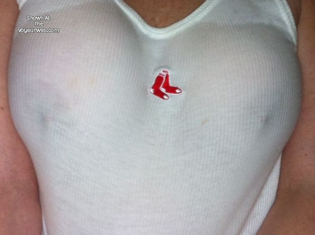Pic #1 My medium tits - SexyRN