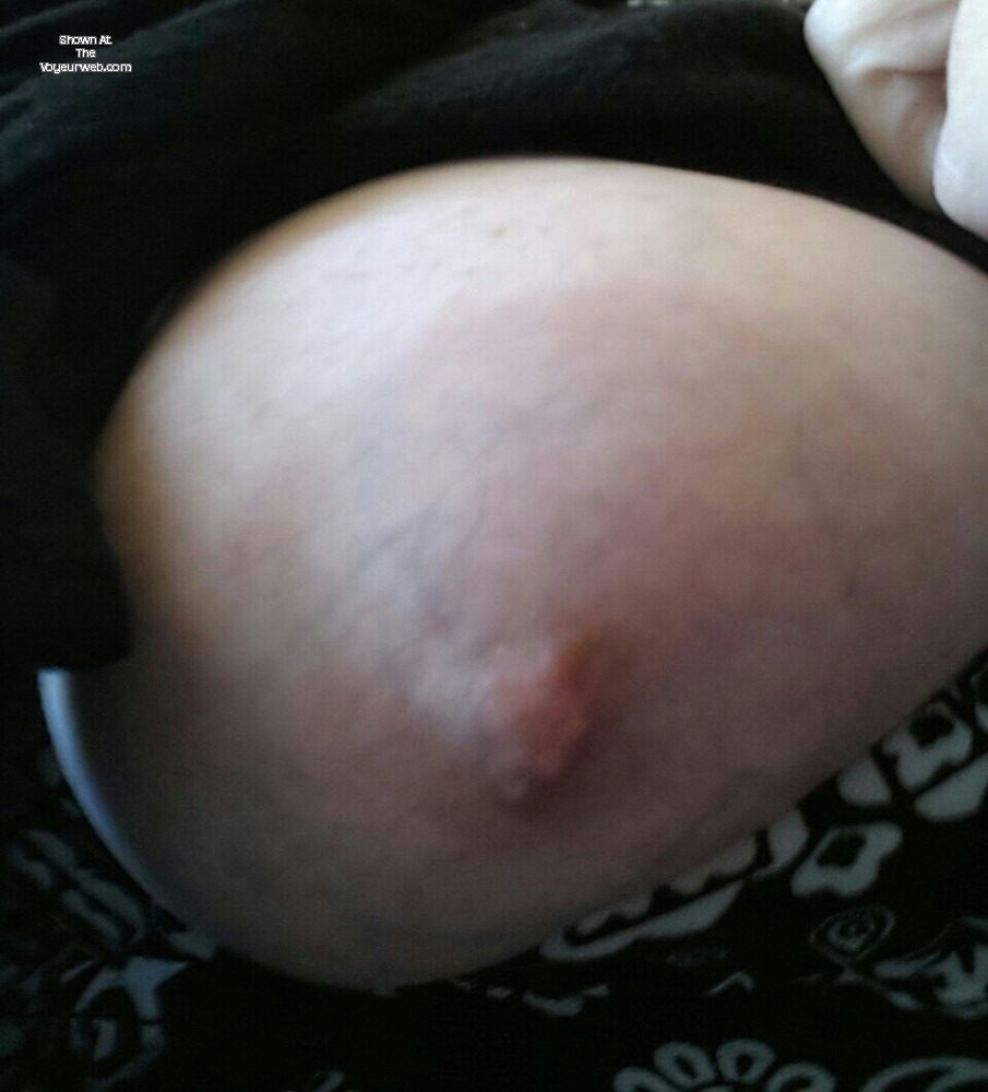 Pic #1 My medium tits - catflash