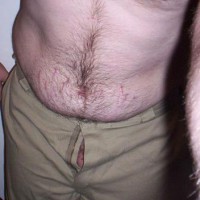 Pic #1First Contri.....be Gentle