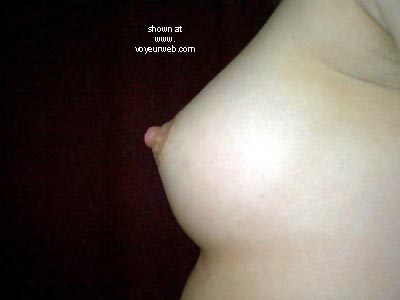 Pic #1Surprise