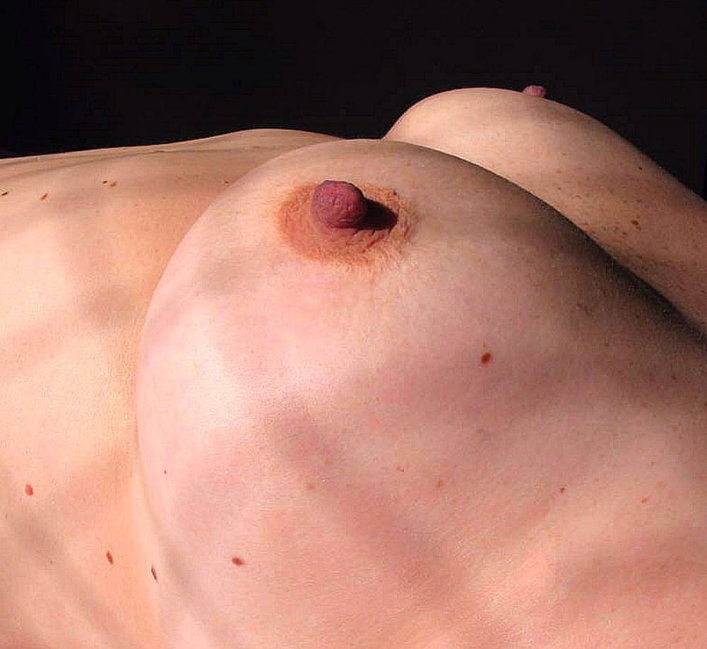 Pic #1 Medium tits of my ex-girlfriend - Claudia 