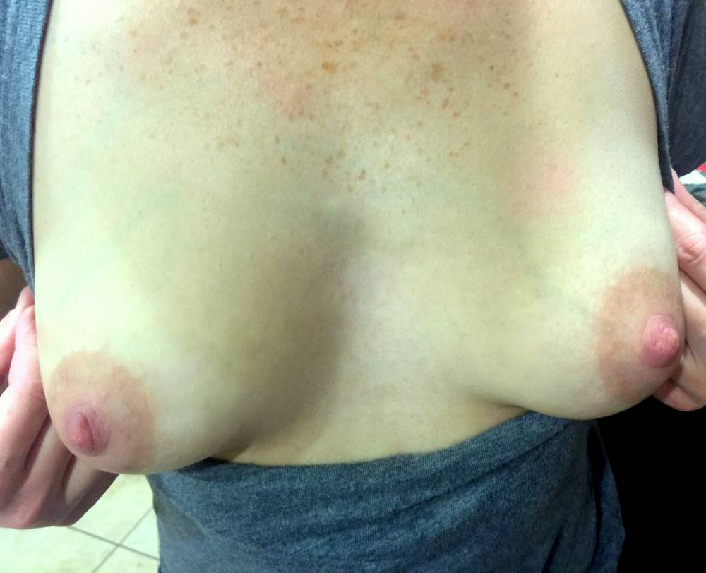 Pic #1 Small tits of my wife - LuvNLife82