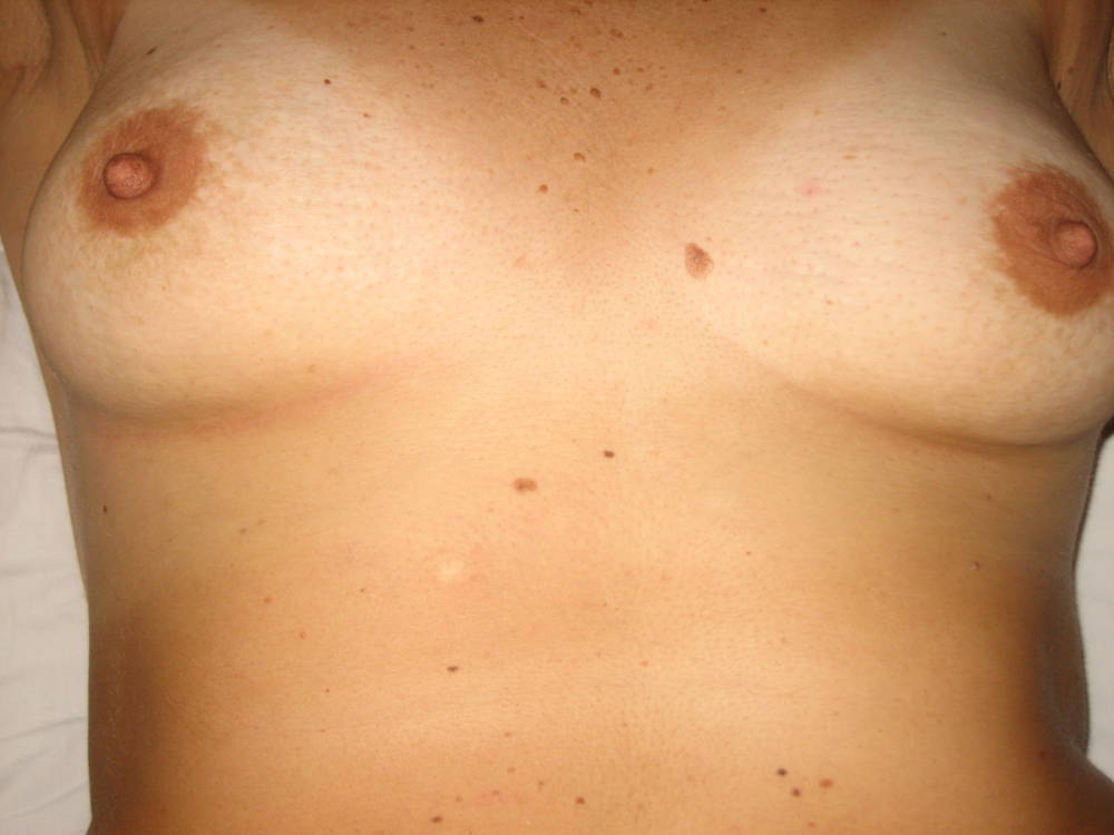 Pic #1 Medium tits of my wife - wife