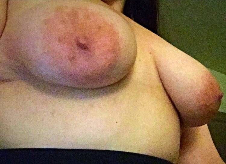 Pic #1 My very large tits - Anne