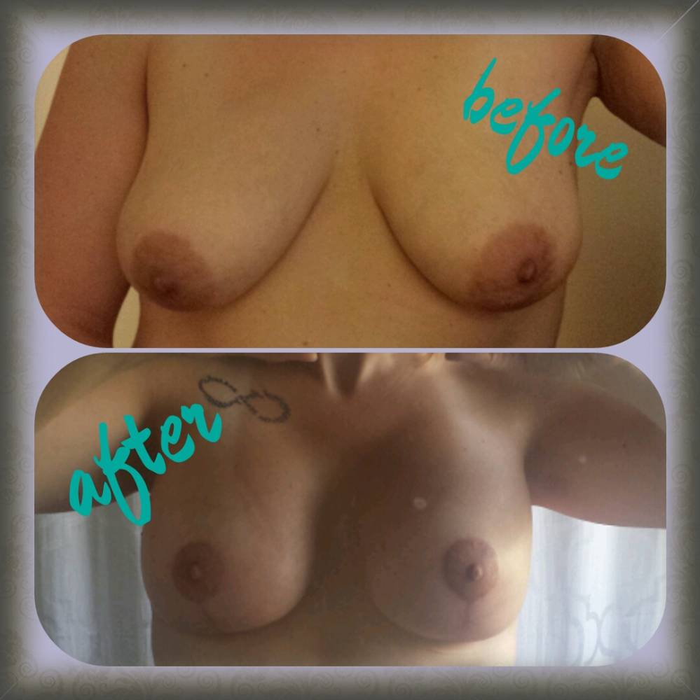 Pic #1 My large tits - Myself
