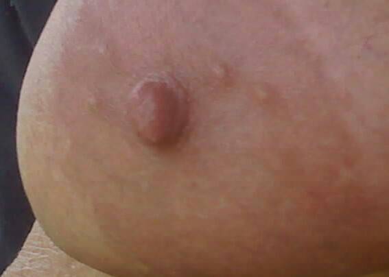 Pic #1 Very large tits of my wife - bigtits