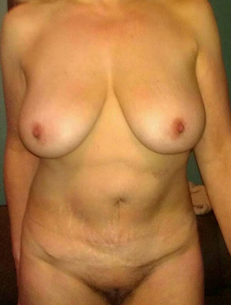 Pic #1 My large tits - 32dd