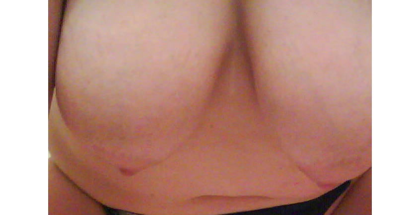 Pic #1 My large tits - Horeva