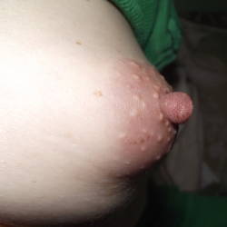 My very small tits - puffy
