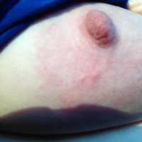 Extremely large tits of a neighbor - big girl