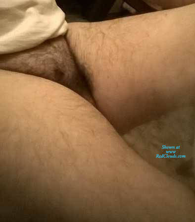 Pic #1M* Io