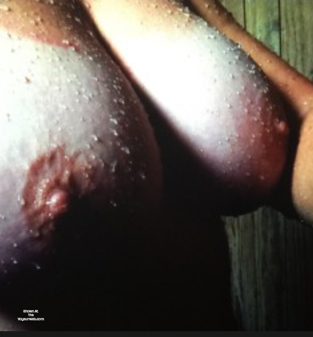 Pic #1 My large tits - Mallory 