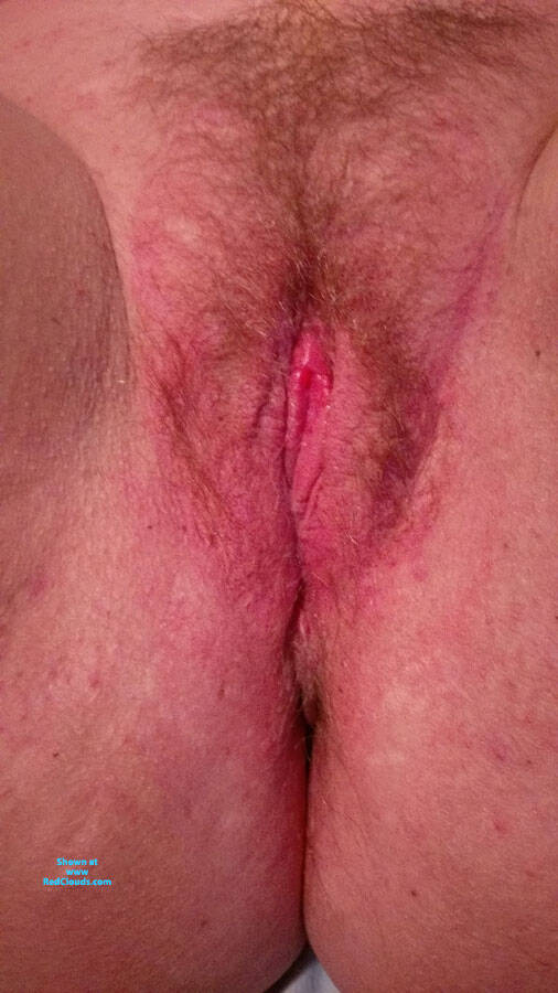 Pic #1 Married Lady Neglected Pussy