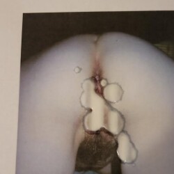 album thumb
