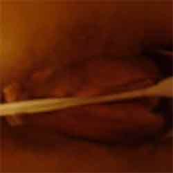 album thumb